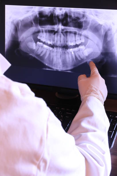 Best Emergency Denture Repair in Winfield, IL
