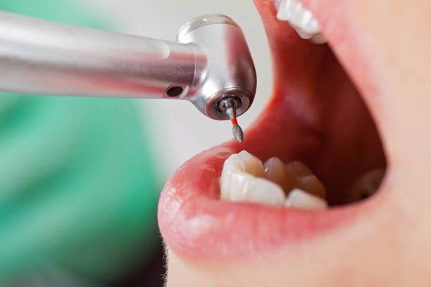 Best Emergency Gum Treatment in Winfield, IL
